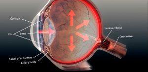 Glaucoma is a common eye condition